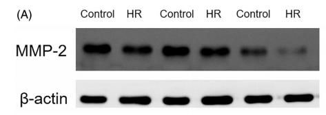 MMP2 Antibody - Figure 4.