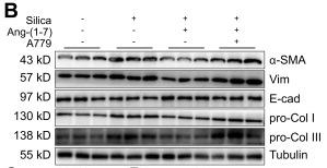 Tubulin alpha Antibody - Figure 7
Ang-(1–7) inhibits SiO2-induced EMT in MLE-12 alveolar type II epithelial cells.