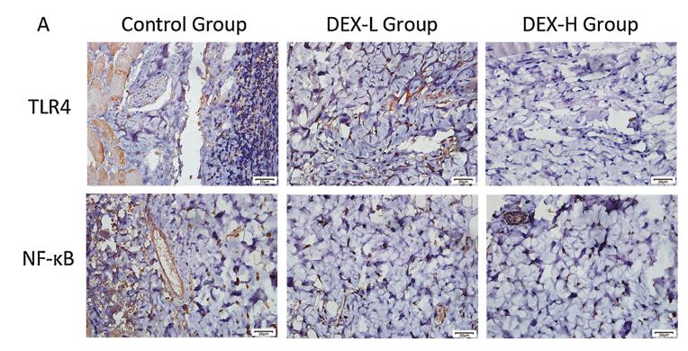NF-kB p65 Antibody - Fig.