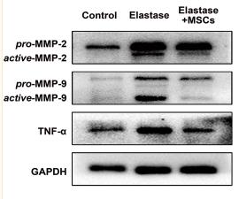 MMP9 Antibody - FIG.