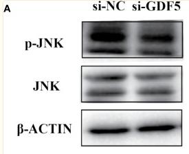 Phospho-JNK1/2/3 (Thr183+Tyr185) Antibody - Figure 8
Knockdown of GDF5 weakened the phosphorylation of JNK and p38 in hPDLSCs.