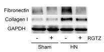 Collagen I Antibody - Figure 3
RGTZ decreases fibronectin and collagen I expression in the kidneys of HN rats.