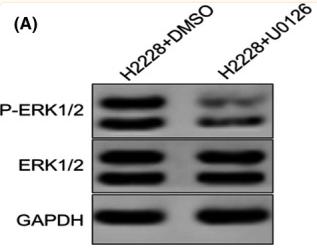 ERK1/2 Antibody - FIGURE 1
Ceritinib reduces programmed cell death ligand‐1 (PD‐L1) expression through the ERK signaling pathway in H2228 cells.