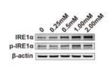 Phospho-IRE1 (Ser724) Antibody - 5 Activation of the PERK pathway involves GSDME-dependent cell death induced by
METH.