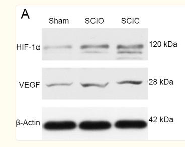 HIF1A Antibody - Figure 6
Influence of spinal canal environment on western blot results after primary spinal cord injury in different groups at 7 days post-operation.