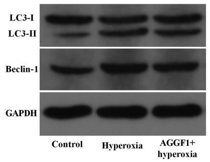 LC3A/B Antibody - FIGURE 4 Representative blots of
autophagy markers LC3‐I, LC3‐II, and Beclin‐1
in RF/6A cells (A) and the ratio of LC3‐II/I and
the relative expression of Beclin‐1 normalized
by GAPDH (B) (*P < .