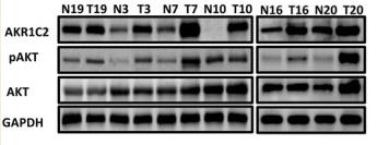 Phospho-AKT1/2/3 (Ser473) Antibody - FIGURE 5
PI3K/AKT signalling pathway was regulated by AKR1C2.