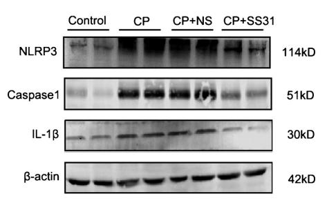 NLRP3 Antibody - Fig.