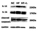 IL1 beta Antibody - Fig.