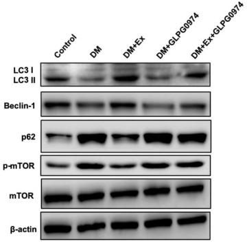 LC3A/B Antibody - Figure 5
Exercise-mediated SCFAs changes ameliorate IR mainly by increasing autophagy in skeletal muscle cells.