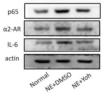 IL6 Antibody - Fig.