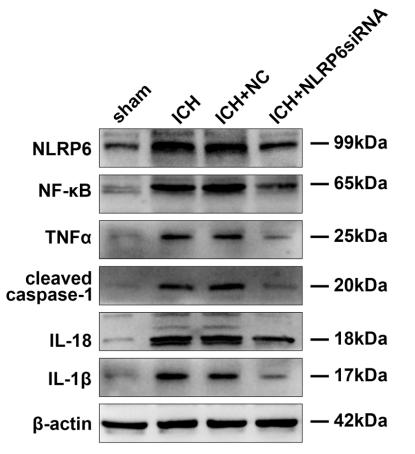 Cleaved-IL-1 beta (Asp116) Antibody - Fig.