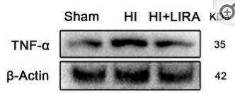 TNF alpha Antibody - Figure 2
Treatment with liraglutide decreased the inflammatory response at both the mRNA and protein levels.