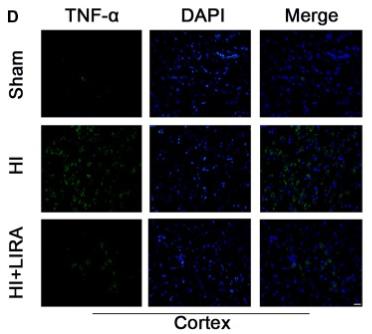 TNF alpha Antibody - Figure 2
Treatment with liraglutide decreased the inflammatory response at both the mRNA and protein levels.