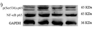 NF-kB p65 Antibody - Fig.