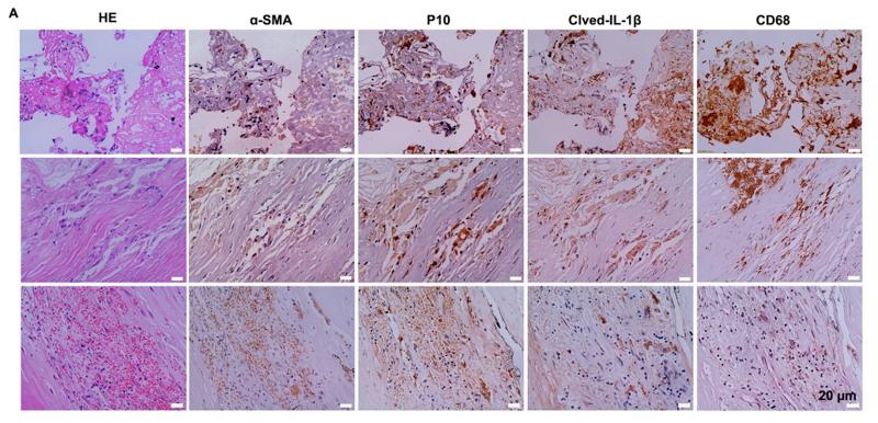 Cleaved-IL-1 beta (Asp116) Antibody - Fig.