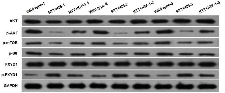Phospho-AKT1/2/3 (Ser473) Antibody - FIGURE 2
Protein phosphorylation for FXYD1 and PI3K/AKT pathway components in the frontal cortex of RTT mice is altered, and IGF-1 treatment reverses the change.