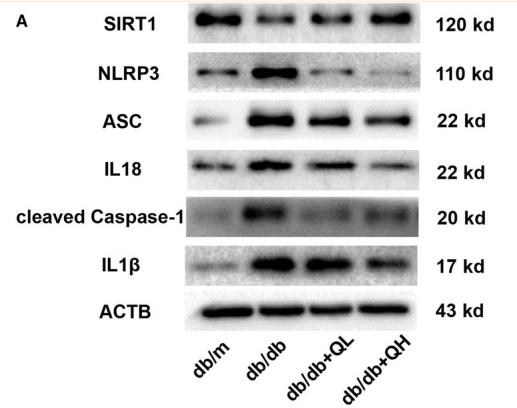 IL18 Antibody - Figure 6
Quercetin activates SIRT1 and inhibits NLRP3 inflammasome activation in the brain of db/db mice.