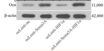 Osteocalcin Antibody - Figure 4
Sema3A and HIF1α co-expression upregulated the expression of osteogenic markers in iPSC-MSCs.