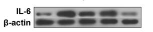 IL6 Antibody - Fig.