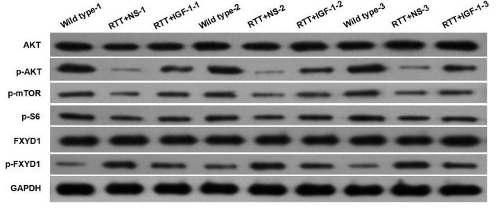 Phospho-mTOR (Ser2448) Antibody - FIGURE 2
Protein phosphorylation for FXYD1 and PI3K/AKT pathway components in the frontal cortex of RTT mice is altered, and IGF-1 treatment reverses the change.