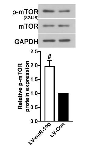 mTOR Antibody - FIGURE 3|MiR-19b-3p overexpression suppressed autophagy via binging to PTEN.