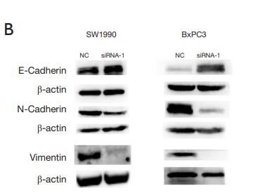 N Cadherin Antibody - Figure 6 | Knock down of lncRNA ELFN1-AS1 inhibited EMT.
