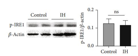 Phospho-IRE1 (Ser724) Antibody - Figure 1: |The PERK pathway but not the ATF-6 or IRE-1 pathway was activated.