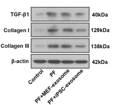 Collagen I Antibody - Fig.