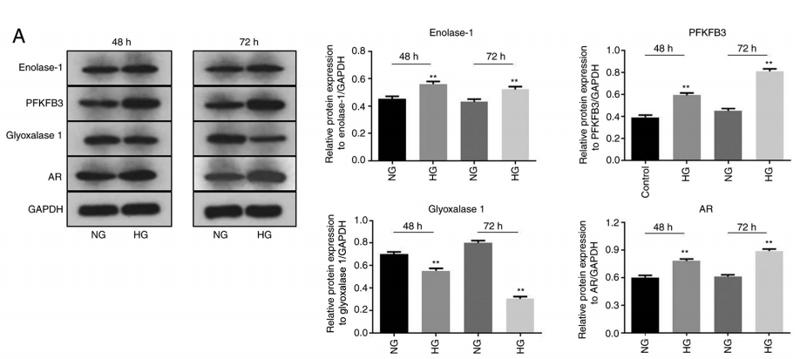 AKR1B1 Antibody - Figure 1.