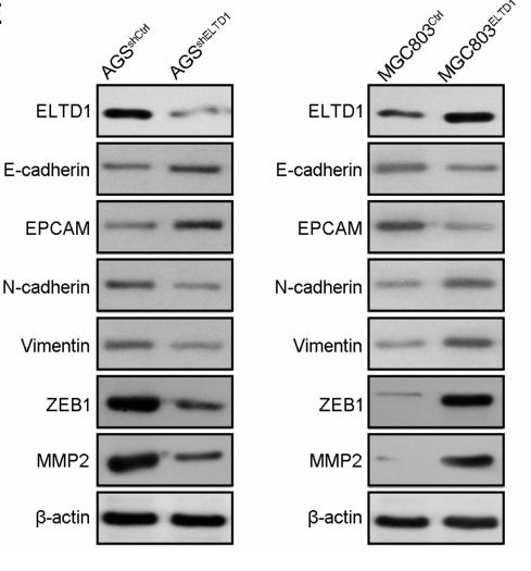 MMP2 Antibody - Figure 3| ELTD1 Facilitates EMT of GC Cells.