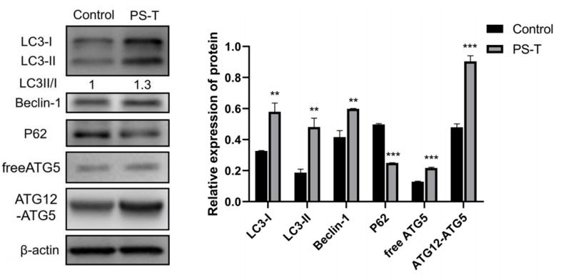 beta Actin Antibody - Fig.