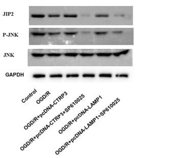 Phospho-JNK1/2/3 (Thr183+Tyr185) Antibody - Figure 6.