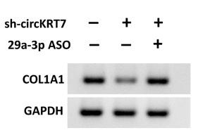 Collagen I Antibody - Figure 3
circKRT7 adsorbed miR-29a-3p to release COL1A1.
