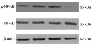 NF-kB p65 Antibody - Figure 6.