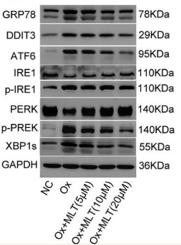 Phospho-IRE1 (Ser724) Antibody - Figure 3.