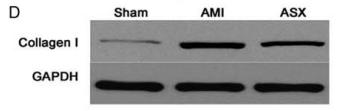Collagen I Antibody - Figure 6: ASX reduced the expression of myocardial fibrosis-related proteins.