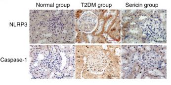 NLRP3 Antibody - Figure 4
Expression of NLRP3 and caspase-1 in the kidney of rats from each group were detected by immunohistochemical staining.