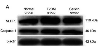 NLRP3 Antibody - Figure 5
Expression of NLRP3 and caspase-1 in the kidney of rats from each group.