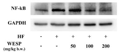 NF-kB p65 Antibody - Fig.