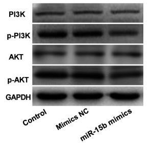PI3K p85 alpha Antibody - Figure 4
miR-15b impairs the activation of PI3K/AKT signalling pathway in oesophageal cancer.