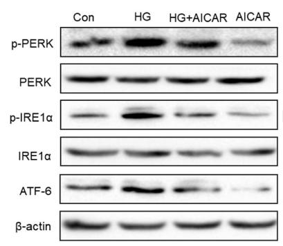 Phospho-IRE1 (Ser724) Antibody - Fig.