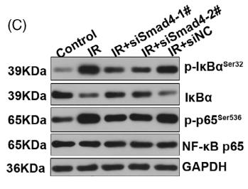 NF-kB p65 Antibody - FIGURE 4 The deficiency of Smad4 inhibited the inflammatory response in a cellular model of human insulin resistance.