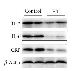 IL6 Antibody - Figure 3
The protective roles of HT administration against atherosclerosis via the pathways of lipid turbulence and inflammation.