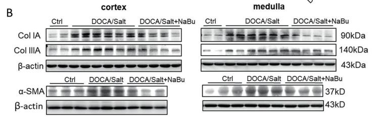 Collagen III Antibody - Fig.