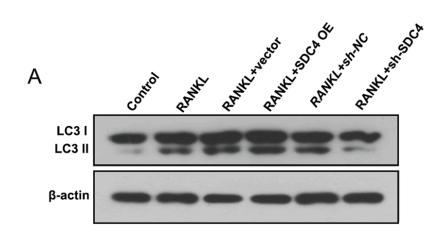 LC3A/B Antibody - Fig.