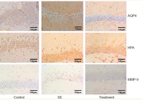 MMP9 Antibody - Figure 3
Effects of the lentivirus encoding sh-LncRNA-5657 on the levels of AQP4, HPA, and MMP-9 immunoreactivities in the hippocampus of septic model rats.