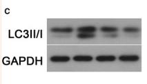 LC3A/B Antibody - FIGURE 1
MiR‐19b‐3p expression and autophagy change in SCI rats.