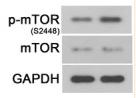 mTOR Antibody - FIGURE 5
MiR‐19b‐3p inhibition alleviated SCI‐induced bone loss in rats.