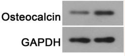 Osteocalcin Antibody - FIGURE 2
MiR‐19b‐3p overexpression inhibited osteogenic differentiation of BMSCs.